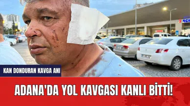 Adana'da yol kavgası kanlı bitti!