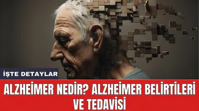 Alzheimer Nedir? Alzheimer Belirtileri ve Tedavisi