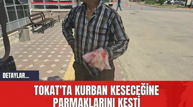 Tokat'ta Kurban Keseceğine Parmaklarını Kesti