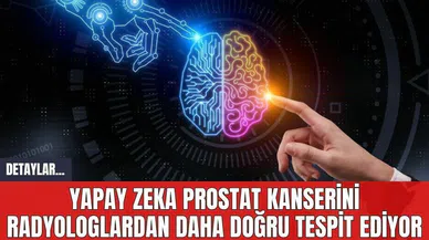 Yapay Zeka Prostat Kanserini Radyologlardan Daha Doğru Tespit Ediyor