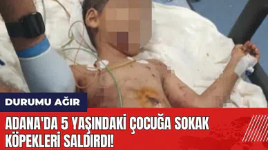 Adana'da 5 yaşındaki çocuğa sokak köpekleri saldırdı! Durumu ağır