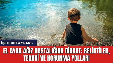 El Ayak Ağız Hastalığına Dikkat: Belirtiler, Tedavi ve Korunma Yolları