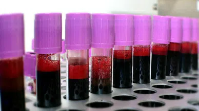 Adrenochrome nedir? Adrenokrom iddiaları gerçek mi?