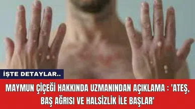 Maymun çiçeği hakkında uzmanından açıklama : 'Ateş, baş ağrısı ve halsizlik ile başlar'