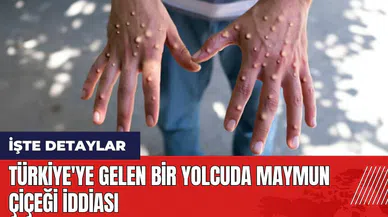 Türkiye'ye gelen bir yolcuda maymun çiçeği iddiası