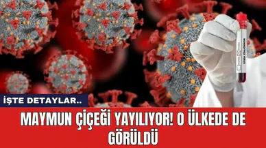 Maymun çiçeği yayılıyor! O Ülkede de görüldü