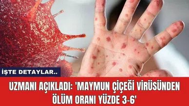 Uzmanı açıkladı: 'Maymun çiçeği virüsünden ölüm oranı yüzde 3-6'