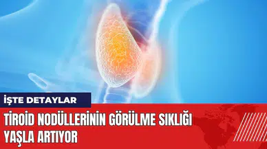 Tiroid nodüllerinin görülme sıklığı yaşla artıyor