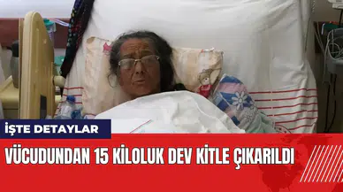 Vücudundan 15 kiloluk dev kitle çıkarıldı