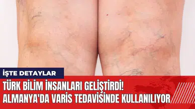 Türk bilim insanları geliştirdi! Almanya'da varis tedavisinde kullanılıyor