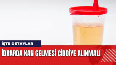 İdrarda kan gelmesi ciddiye alınmalı
