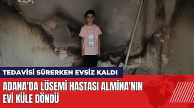 Adana'da lösemi hastası küçük Almina'nın evi yandı
