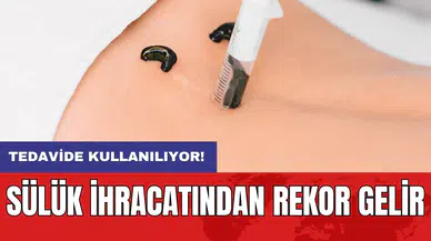 Tedavide kullanılıyor: Sülük ihracatından rekor gelir