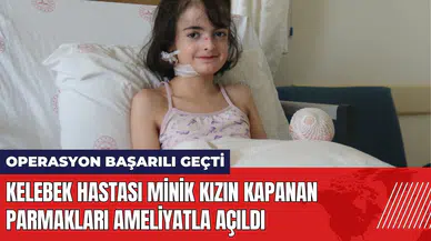 Kelebek hastası minik kızın kapanan parmakları ameliyatla açıldı