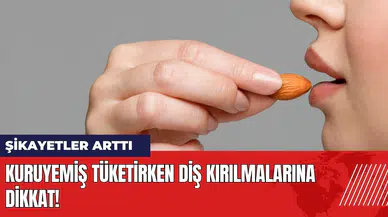 Kuruyemiş tüketirken diş kırılmalarına dikkat! Şikayetler arttı