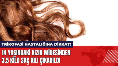 14 yaşındaki kızın midesinden 3.5 kilo saç kılı çıkarıldı!