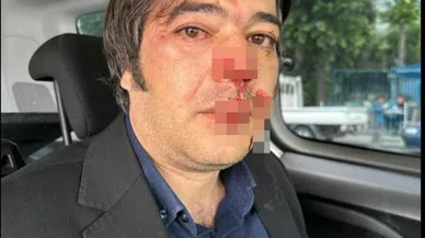 Kaçak yapının yıkımı sırasında arbede: İmar müdürü darp edildi