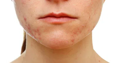 Makyaj malzemelerinin yan etkilerine dikkat!