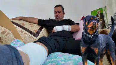 Mersin Erdemli'de Köpek Saldırısı: Yaşadığı Dehşeti Anlattı