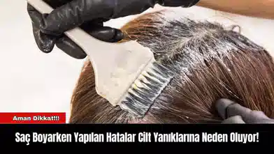 Saç Boyarken Yapılan Hatalar Cilt Yanıklarına Neden Oluyor!