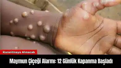 Maymun Çiçeği Alarmı: 12 Günlük Kapanma Başladı