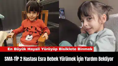 SMA-TİP 2 Hastası Esra Bebek Yürümek İçin Yardım Bekliyor