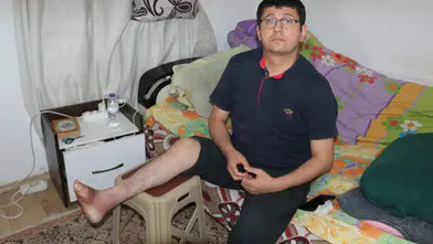 Antalya'da 18 Yıldır Kapanmayan Yara Hayatını Kararttı: 10 Ameliyat Geçirdi, Tanı Bekliyor