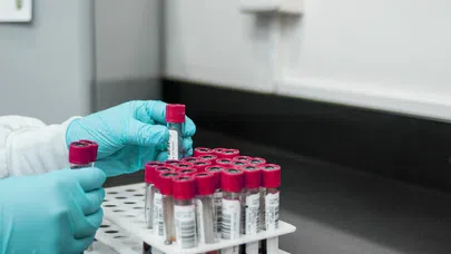 Tıbbi laboratuvar testleri hizmeti alınacak