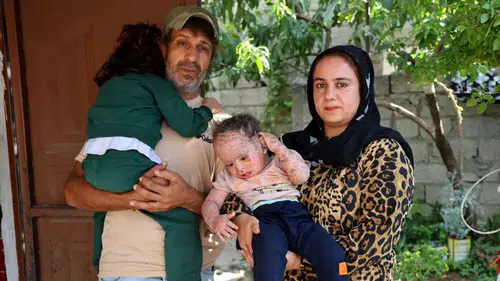 Adana’da Vicdansızlar Küçük Yusuf’un Tedavi Parasını Çaldılar!