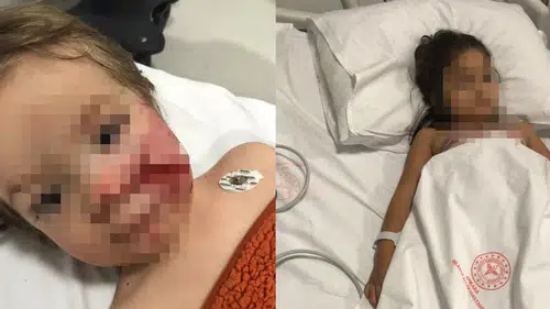 Korkunç Saldırı Sonrası Tutuklama: Pitbull Sahibi Cezaevine Gönderildi