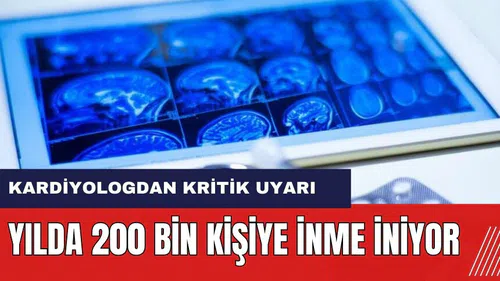 Kardiyologdan kritik uyarı! Yılda 200 bin kişiye inme iniyor