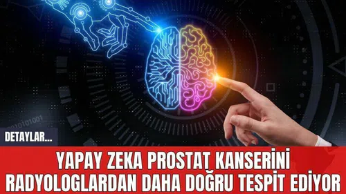 Yapay Zeka Prostat Kanserini Radyologlardan Daha Doğru Tespit Ediyor