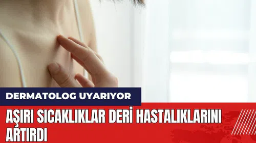 Aşırı sıcaklıklar deri hastalıklarını artırdı