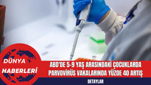 ABD'de 5-9 Yaş Arasındaki Çocuklarda Parvovirüs Vakalarında Yüzde 40 Artış