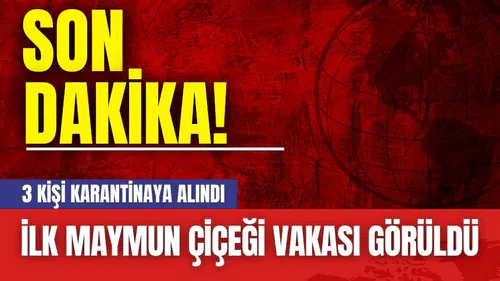 Korkulan oldu! İlk maymun çiçeği vakası görüldü