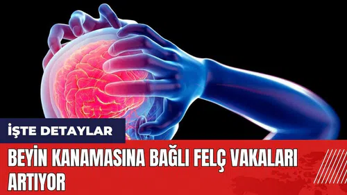 Beyin kanamasına bağlı felç vakaları artıyor