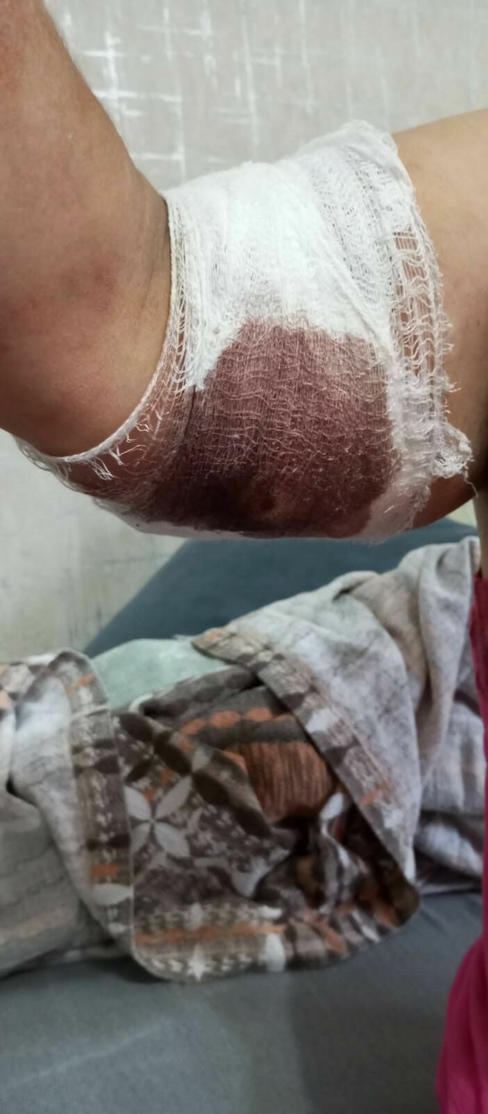 Hatay'da Köpeklerin Saldırısına Uğradı O An Öldüğümü Sandım
