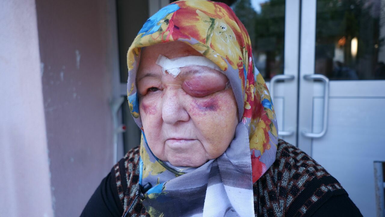 Edirne’de Başıboş Köpeklerin Saldırısına Uğradi2