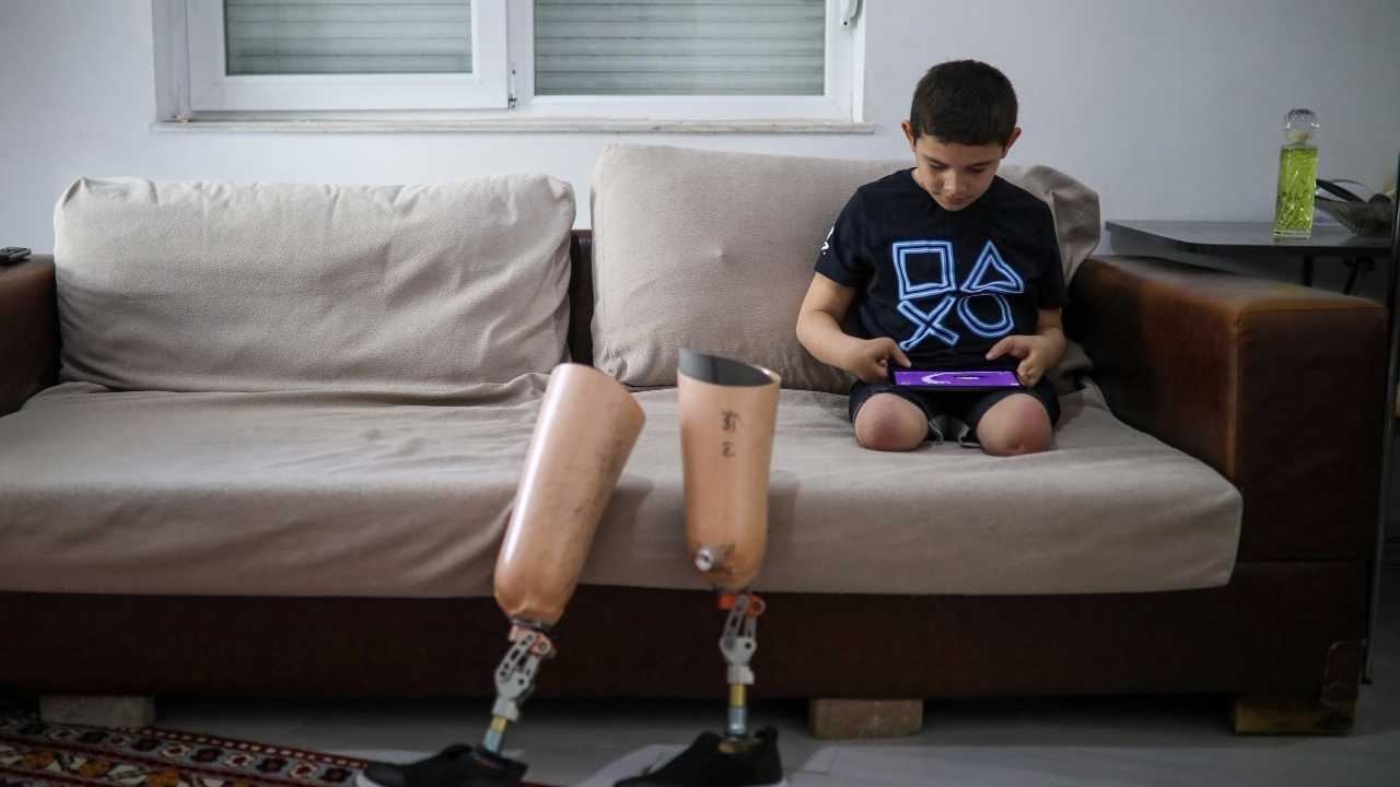 Kepez'de Bacakları Kesilen Aras'ın Protezleri İcralık Oldu 3