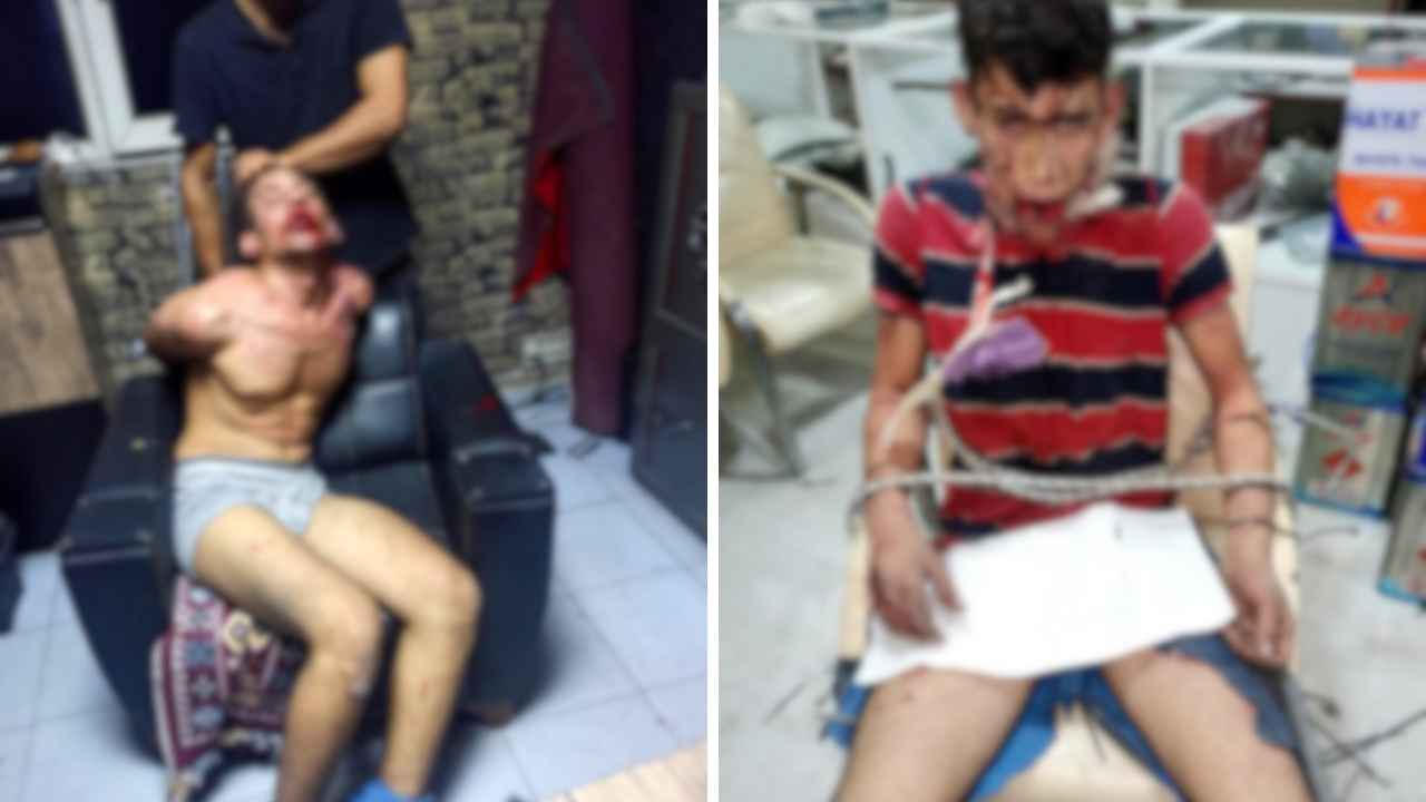 Antalya'da Dişleri Kırılıp Hamam Böceği Yedirildi! O Rapora İsyan Etti 2
