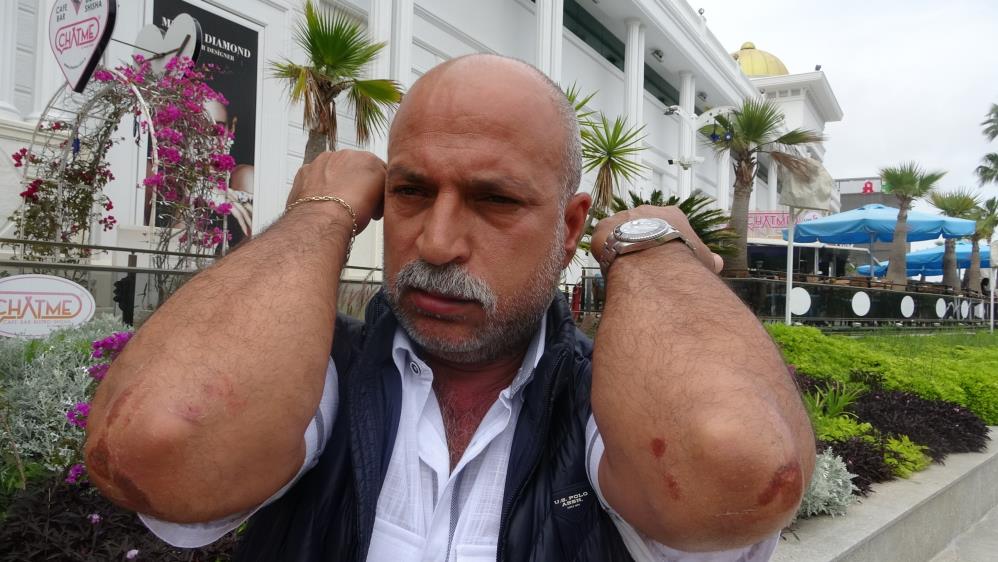 Dernek Başkan Yardımcısına Kundu'da Saldırı