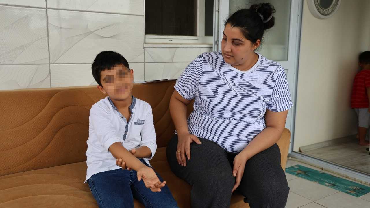 Adana’da 7 Yaşındaki Otizmli Çocuğa Darp Şüphesi 2