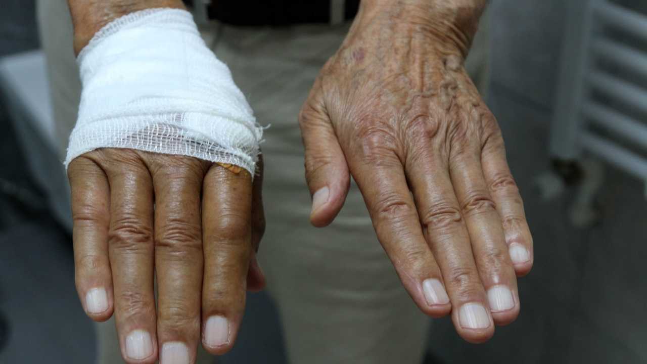 Antalya'da Duş Yaparken Kabin Camı Patladı! Eline 20 Dikiş Atıldı 2