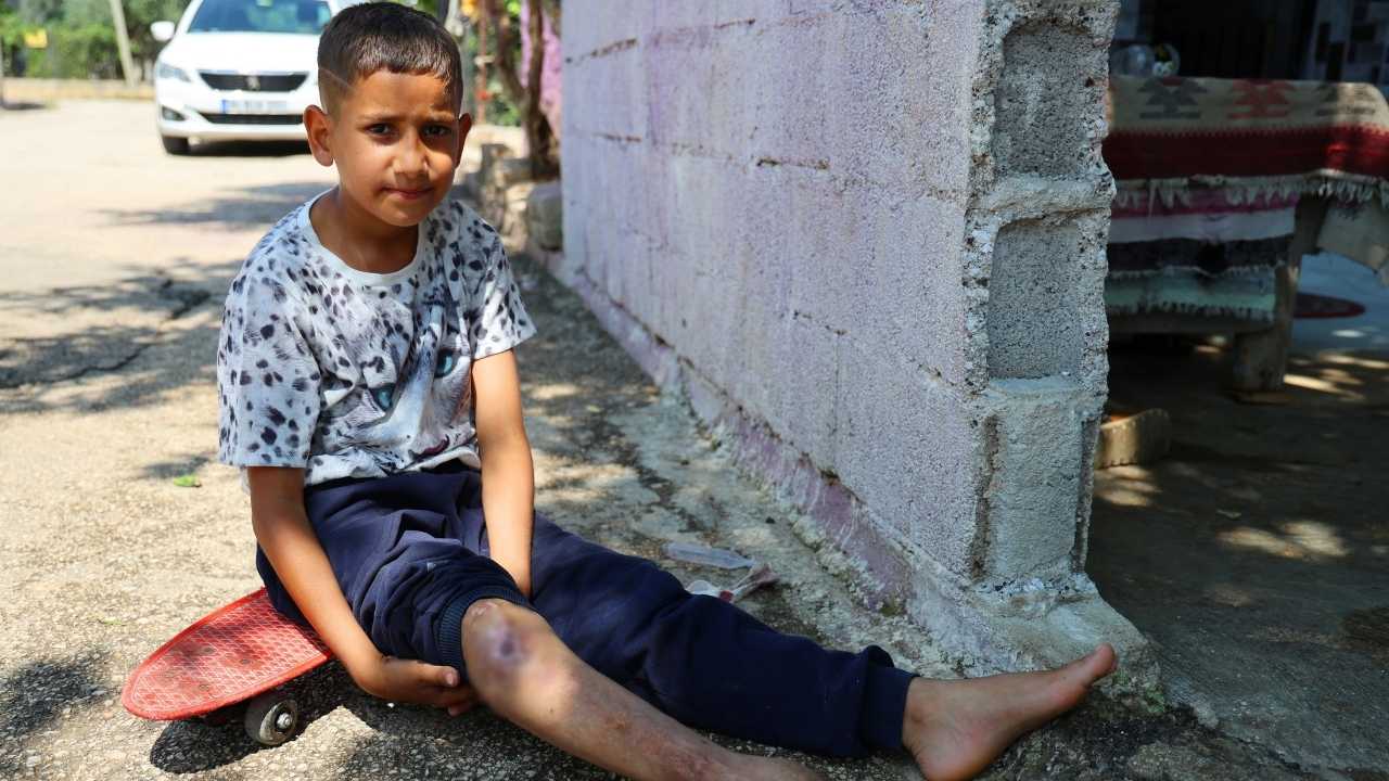 Adana’da Minik Serdal Yaşıtları Gibi Okula Gitmek İstiyor 4