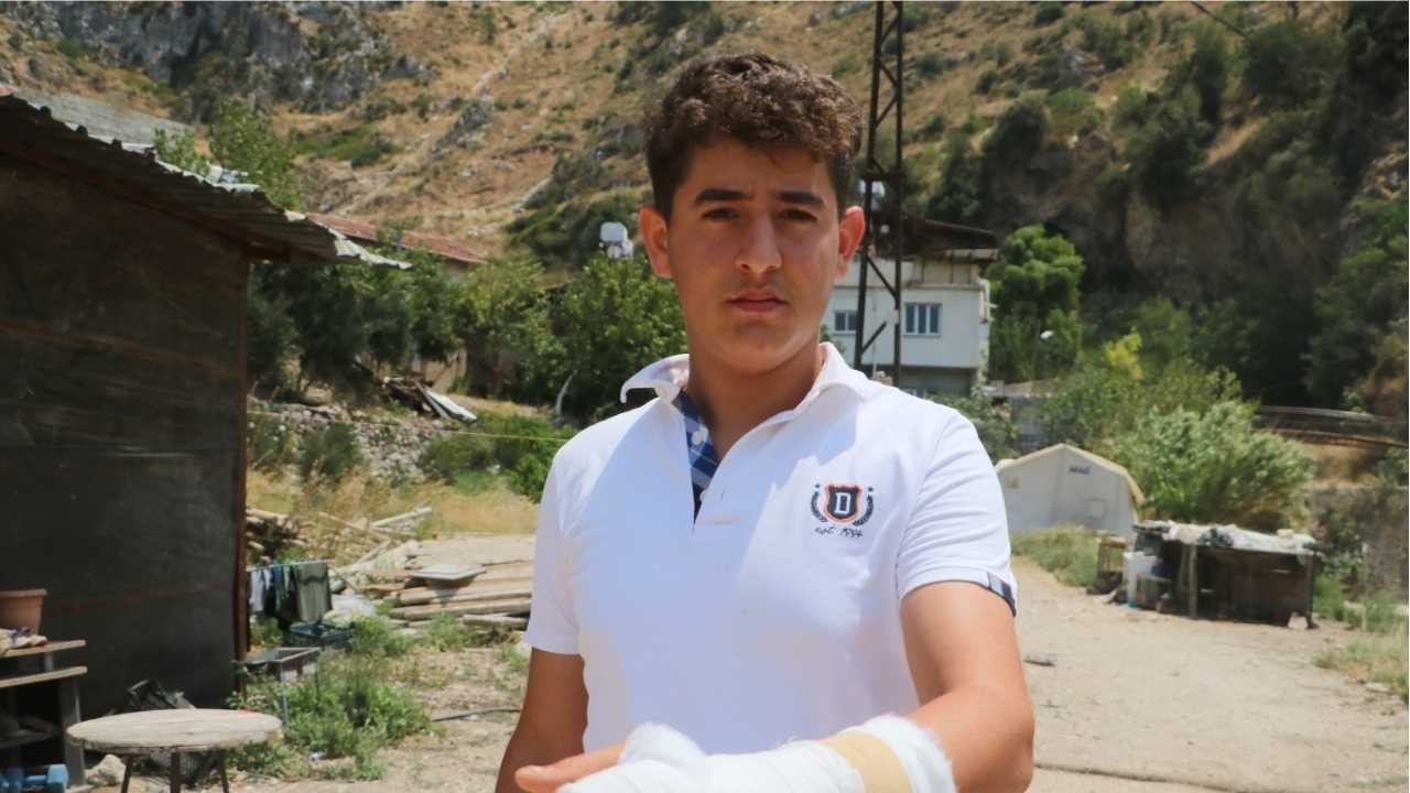 Alevlere Direnen Gencin Eli Kırıldı