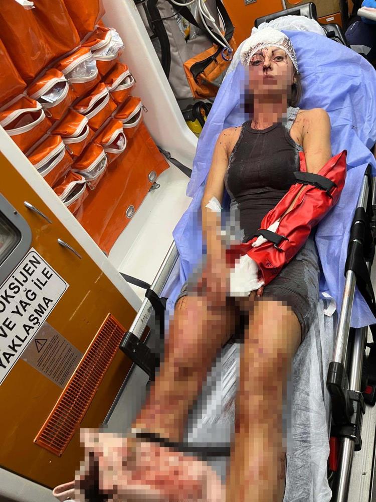 Antalya'da Uzaklaştırma Kararı Alan Kadın Sopalı Şiddete Uğradı
