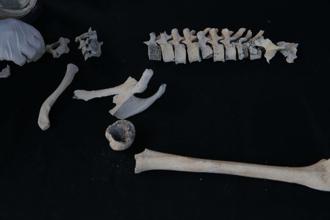 Kazılarda Bulunan İskeletlerden Antik Hastalıklar Bulunacak 11