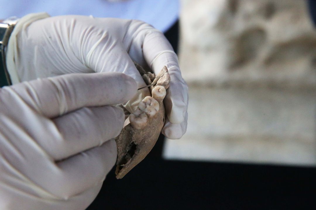 Kazılarda Bulunan İskeletlerden Antik Hastalıklar Bulunacak 8