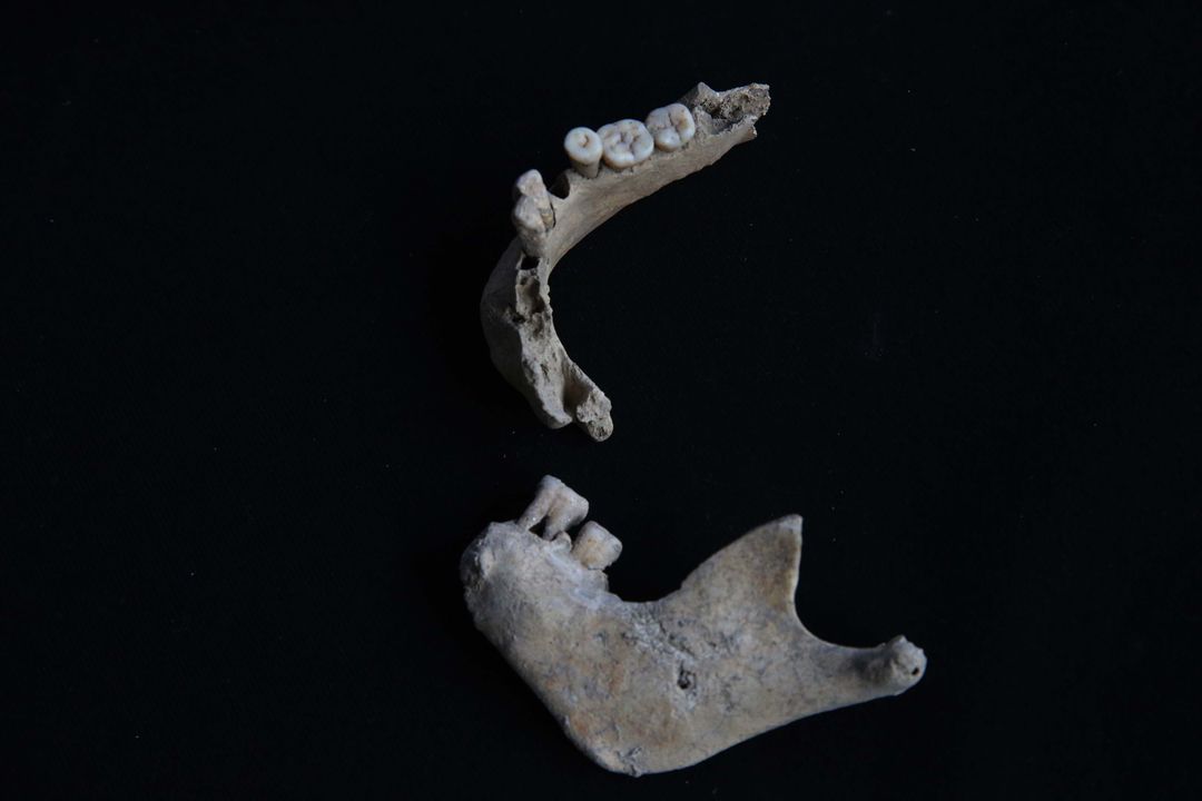 Kazılarda Bulunan İskeletlerden Antik Hastalıklar Bulunacak 3