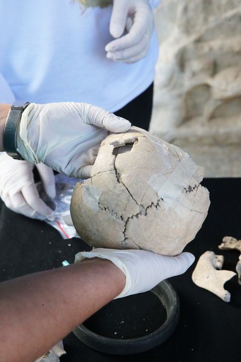 Kazılarda Bulunan İskeletlerden Antik Hastalıklar Bulunacak 7